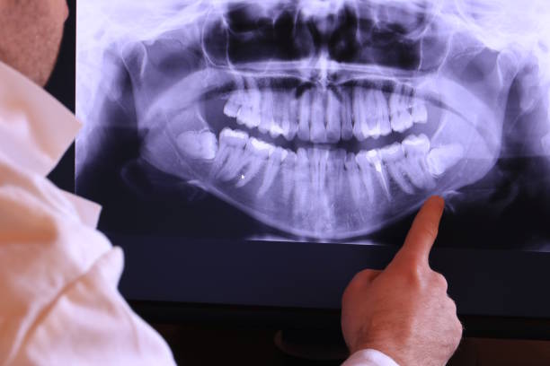 Best Emergency Treatment for Dental Infections or Abscesses in Hurricane, UT