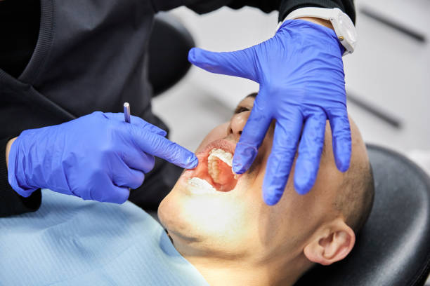 Best Emergency Dental Care for Broken or Chipped Teeth in Hurricane, UT